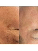 ル ボヌール&nbsp;肌悩み 全て解消