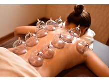 トータルボディケアスマイル(Smile)/カッピング（吸玉）