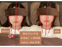 整体サロン宇宙/☆本格あご・小顔矯正☆