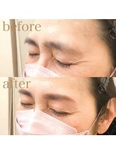 プラスキュア 用賀店(+CURE)/眉毛スタイリングお客様デザイン