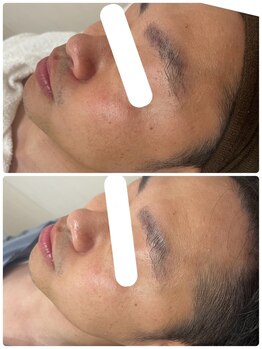 ムー(mu)/ララピール/トーンアップ/ツヤ