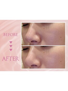 お肌をきれいにしたい