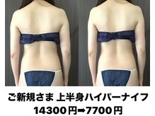 バーテックスキー(Vertexkey)/上半身ケア