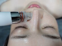 [五反田/小顔/小顔矯正/毛穴/毛穴洗浄/フェイシャル/ララピール]