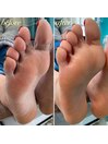 フット角質ごっそりオフ