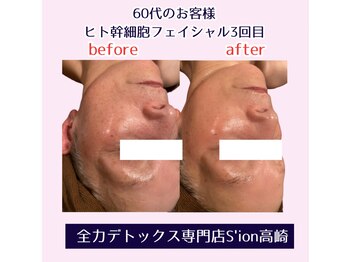 シオン 高崎(S'ion)/