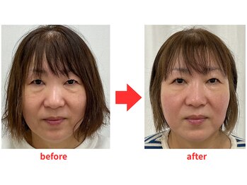 ブプラ 小倉店(BUPURA)/