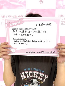 ルアナシンフォニア エクシア 東銀座店(Luana-Sinfonia)/ホワイトニングビフォーアフター