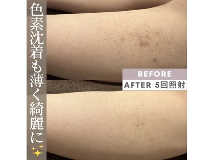モアトゥインクル 福山宮通り店(MORE twinkle)の写真