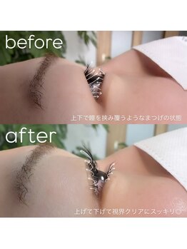 ビューティーグロウ(BEAUTY-GROW)/