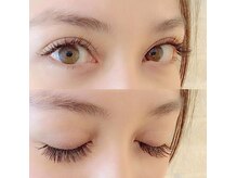 ヒール スパ(heal spa)/逆まつげの方に！