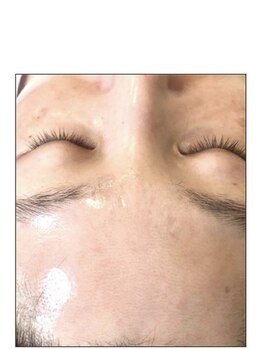 ノーブル 新宿南口(NOBLE)/ハーブピーリング専門新宿