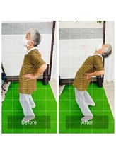 門前仲町イエティ鍼灸整骨院（旧：イエティ鍼灸整骨院）/ビフォーアフター♪