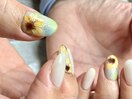 夏ネイル &nbsp;ひまわり