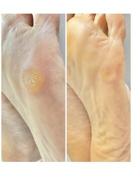 ラヴィ(La vie)/3回目でよくなりました