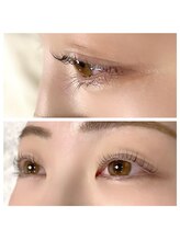 ソート(THOUGHT)/ラッシュリフト