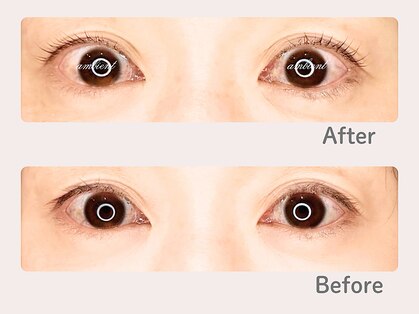 アンビエント(AMBIENT)の写真