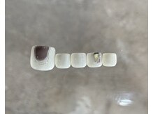 コロレ バイ エルナ(clore by ELNA)/フット定額デザイン￥8,000