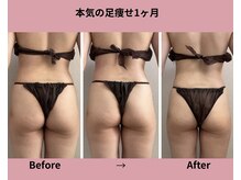 タノソイネ(tanosoine)/【40代/ハイパーナイフ痩身】