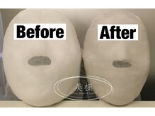 美極 トータルビューティー(美極 TOTAL BEAUTY)/恵比寿/小顔コルギ/エステ/