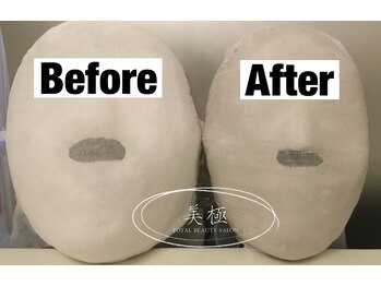 美極 トータルビューティー(美極 TOTAL BEAUTY)/恵比寿/小顔コルギ/エステ/