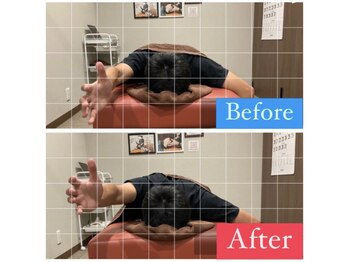 ナオル整体 宮崎院(NAORU整体)/40代男性施術事例【円背姿勢】