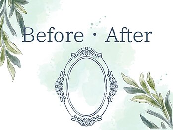 鍼灸院凪/カリム(Calme)/こんな違いを体感してください