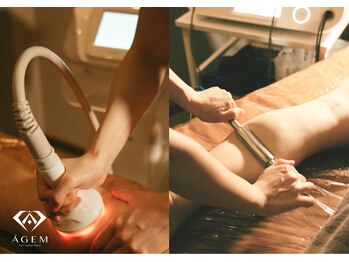 アージェム(AGEM)