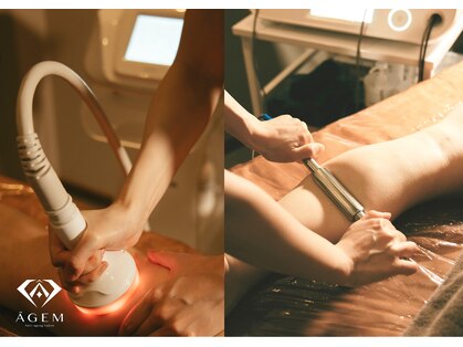 アージェム(AGEM)の写真