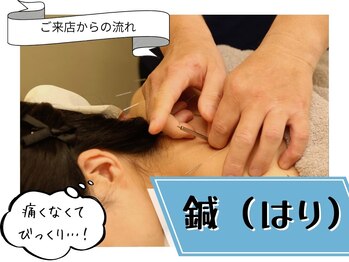 寝屋川かわい鍼灸整骨院/肩こりの改善にはり