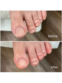 レフス 北参道店(REFUSS)/爪カッティング