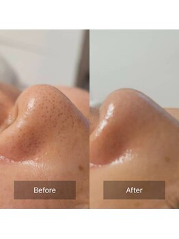 ローハ(ROHA)/クリニック提携のサロンの強み☆