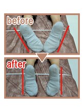 子の星整体院/足首の施術