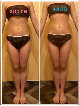 フェルナ(FERNA)/体質ケア/スタイルUP