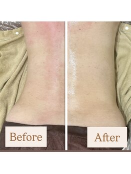 クリニカルホワイトケア 和泉府中店(クリニカルWHITEケア)/痩身 ダイエット お腹