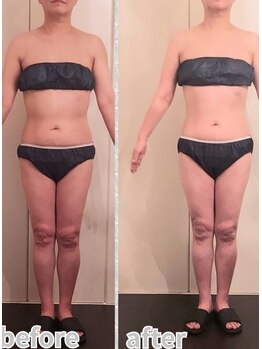 アヴニール(Avenir)/美形成オイルマッサージ