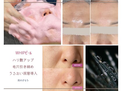 泡のきもちの写真