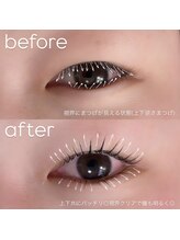 ビューティーグロウ(BEAUTY-GROW)/