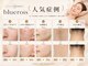 ブルーロワーズ(bluerois)の写真