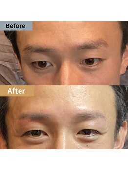 眉毛ハウス 吉祥寺店(眉毛HOUSE)/お客様の施術例(吉祥寺/東京)