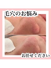 サロンシャイン(Salon Shine)/毛穴美人コース