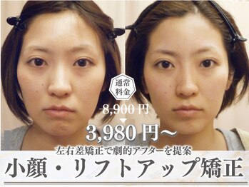 モアフェイス 池袋店(More Face)の写真/◆頬骨矯正が大得意サロン◆熟練スタッフがフェイスラインを造る！【ゆがみ矯正＋リンパ矯正3980円~】