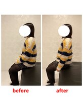 ナオル整体 福岡香椎院(NAORU整体)/20代女性施術事例【猫背】