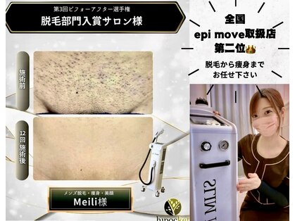 メイリー(Meili)の写真