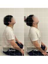 ナオル整体 池袋院(NAORU整体)/首を動かすのが楽に！【池袋駅】