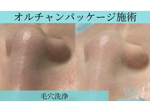 リメイククリニカルビューティー(Remake clinical beauty)/オルチャンパッケージ