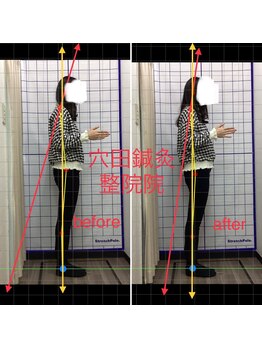 穴田鍼灸整骨院/整体・骨盤・ねこぜ・まき肩矯正