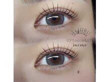 アップフォースリフト(UPforceLift)