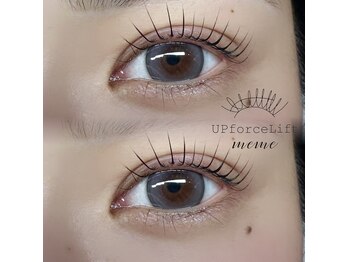 アップフォースリフト(UPforceLift)