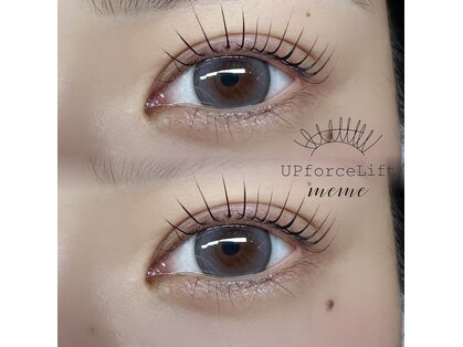 アップフォースリフト(UPforceLift)の写真